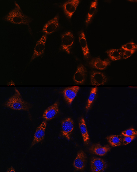Aquaporin-8 Antibody - BSA Free