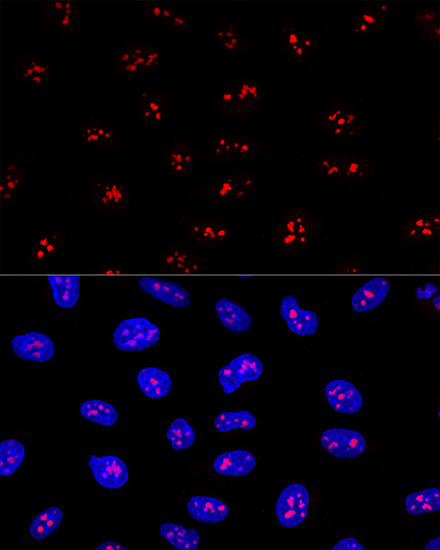 EBNA1BP2 Antibody - BSA Free