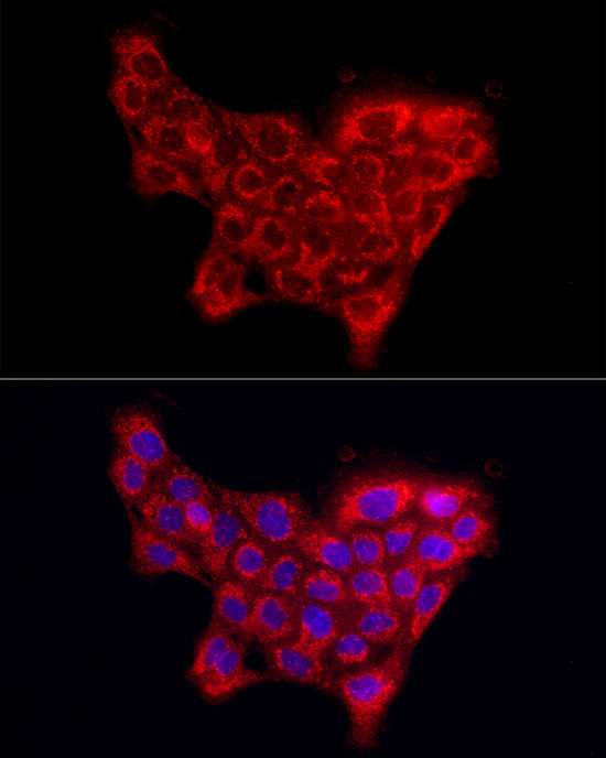 Collagen IV alpha5 Antibody - BSA Free
