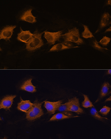 ATPase Na+/K+ beta 2 Antibody - BSA Free
