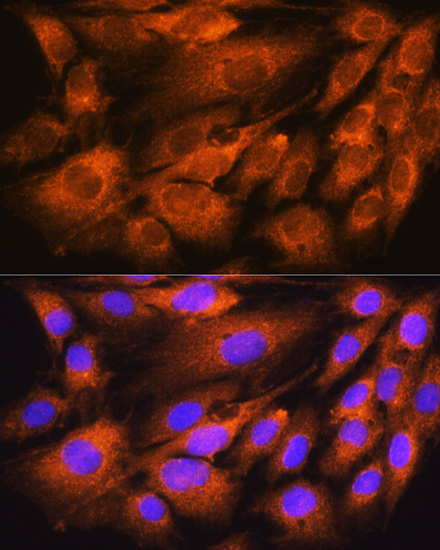 ATP5D Antibody - BSA Free