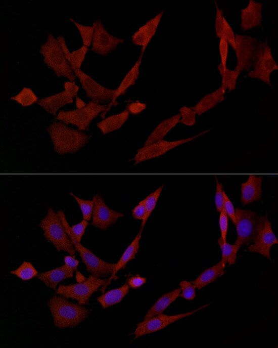 DOK4 Antibody - Azide and BSA Free
