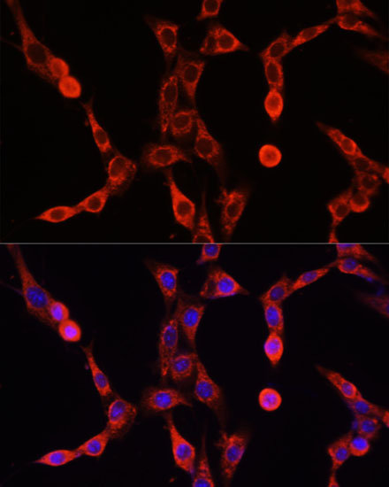 ABCD1 Antibody - Azide and BSA Free
