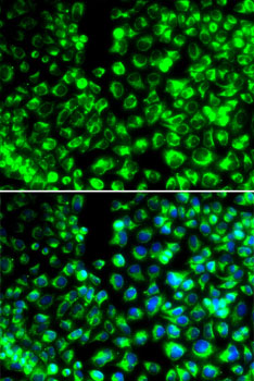 Calumenin Antibody - BSA Free