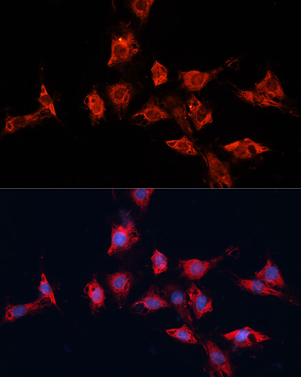 ADAM11 Antibody - Azide and BSA Free