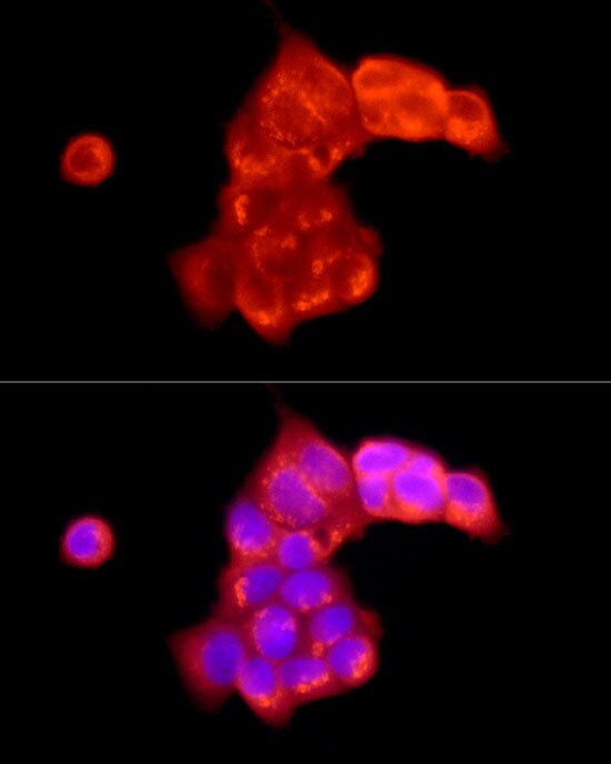 ATP6V0C Antibody - Azide and BSA Free