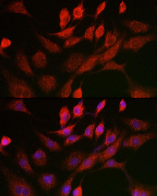 Adenine Nucleotide Translocase 1 Antibody - Azide and BSA Free