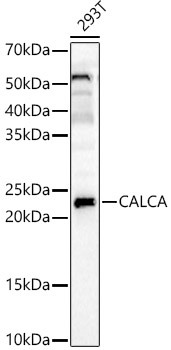 APRT Antibody - BSA Free