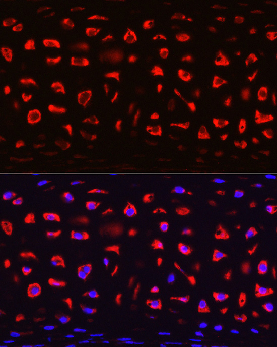 COMP/Thrombospondin-5 Antibody - Azide and BSA Free