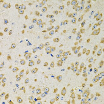 Adenylosuccinate Synthase Antibody - BSA Free