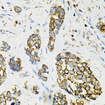 Adenylosuccinate Synthase Antibody - BSA Free
