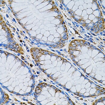 Adenylosuccinate Synthase Antibody - BSA Free