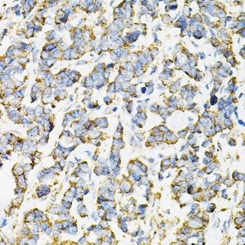 Adenylosuccinate Synthase Antibody - BSA Free