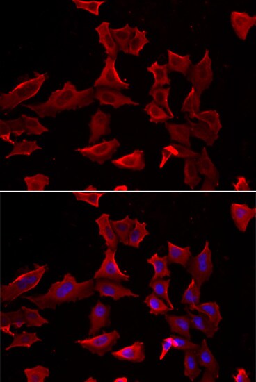 Adenylosuccinate Synthase Antibody - BSA Free