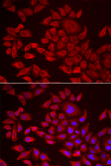 AGPAT2 Antibody - BSA Free