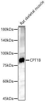 CPT1B Antibody - BSA Free