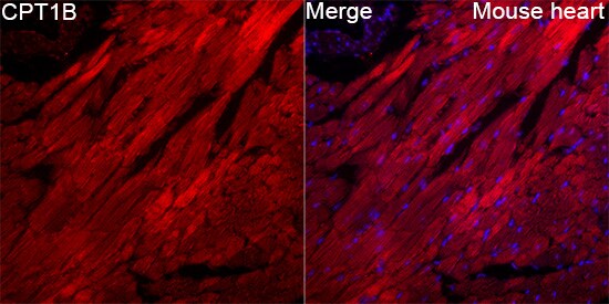 CPT1B Antibody - BSA Free