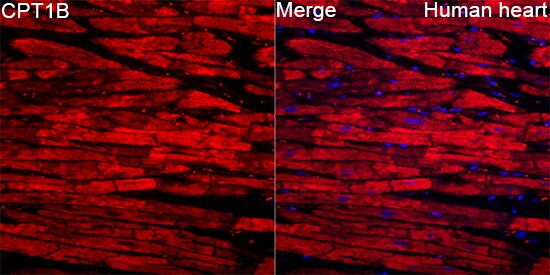 CPT1B Antibody - BSA Free