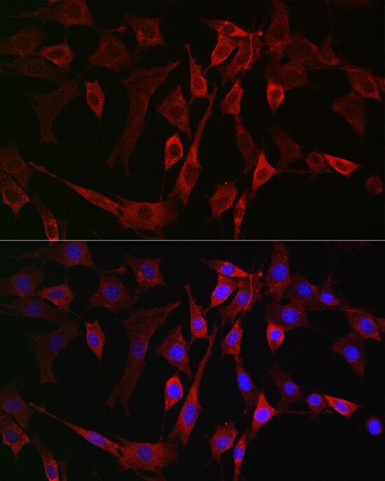 15-Lipoxygenase 2 Antibody - Azide and BSA Free