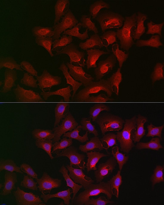 15-Lipoxygenase 2 Antibody - Azide and BSA Free