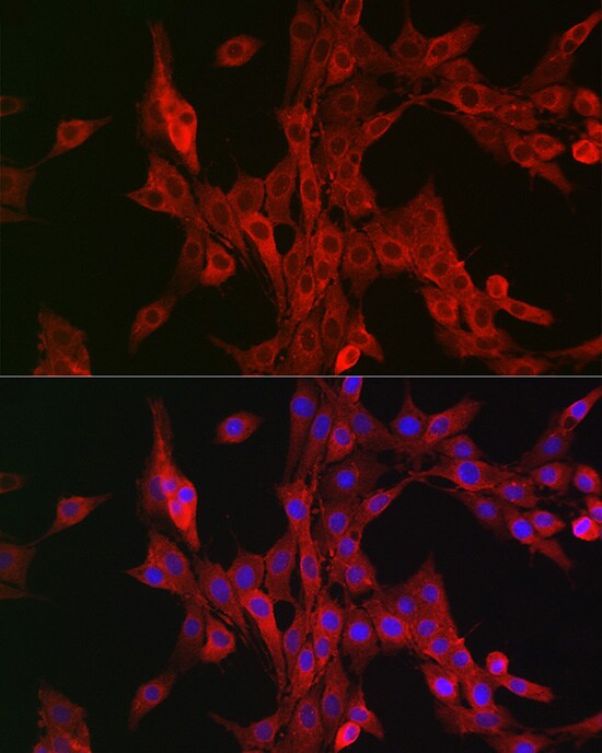 15-Lipoxygenase 2 Antibody - Azide and BSA Free