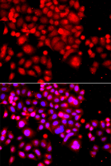 ASCC3 Antibody - BSA Free