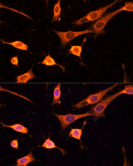 BFAR Antibody - BSA Free