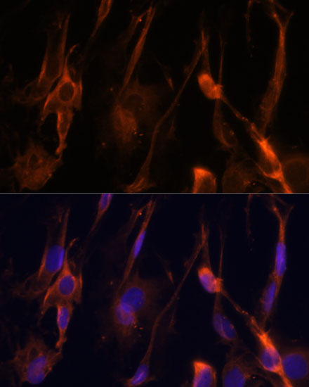 BFAR Antibody - BSA Free