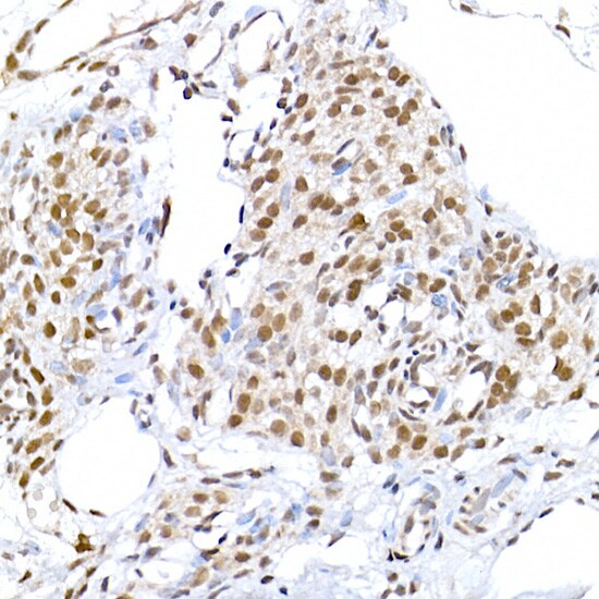 DNA Ligase III Antibody - Azide and BSA Free
