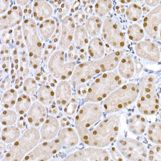 DNA Ligase III Antibody - Azide and BSA Free