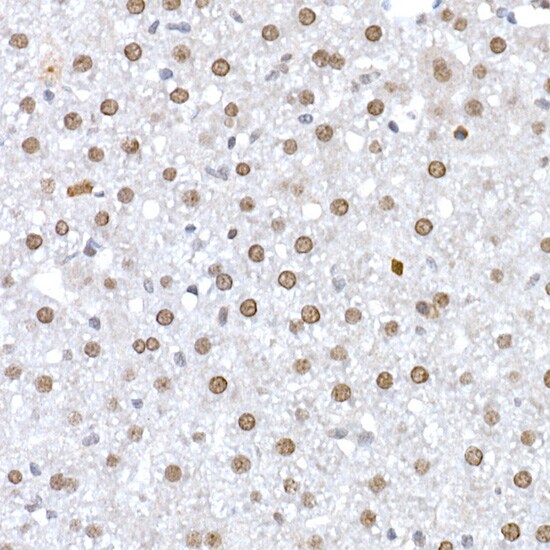 DNA Ligase III Antibody - Azide and BSA Free
