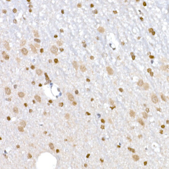 DNA Ligase III Antibody - Azide and BSA Free