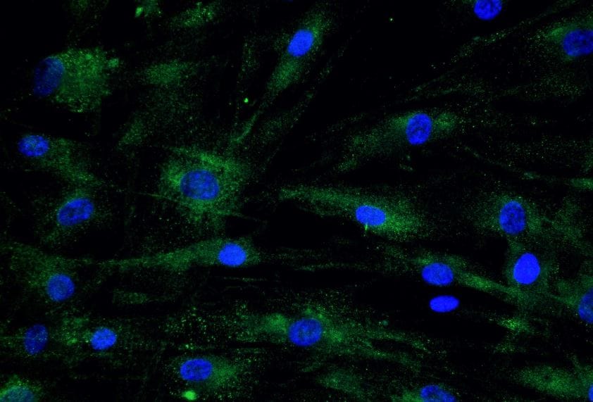 COMP/Thrombospondin-5 Antibody