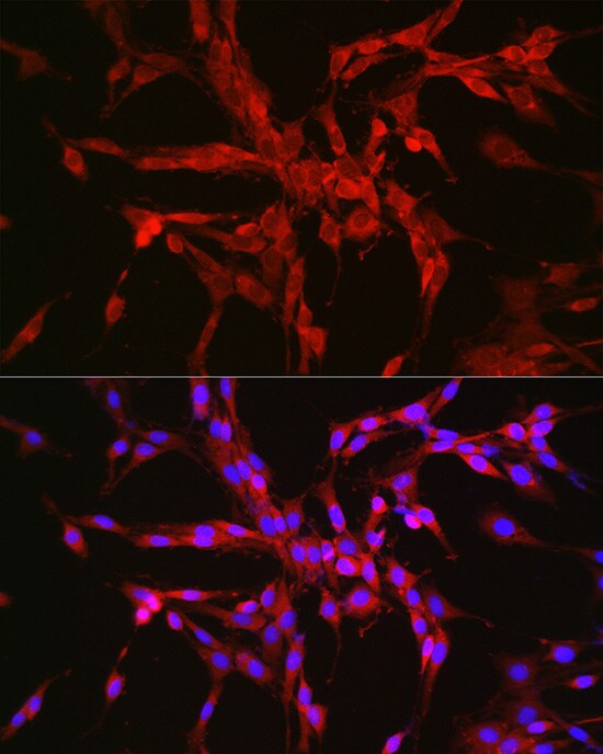 Catenin alpha 2 Antibody - Azide and BSA Free