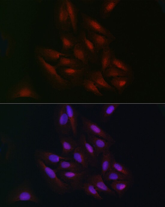 C9orf72 Antibody - Azide and BSA Free