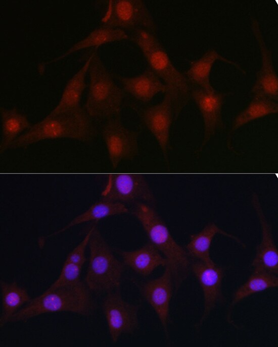 C9orf72 Antibody - Azide and BSA Free