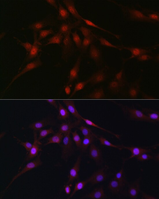 C9orf72 Antibody - Azide and BSA Free