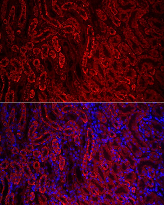 ACSL1 Antibody - Azide and BSA Free