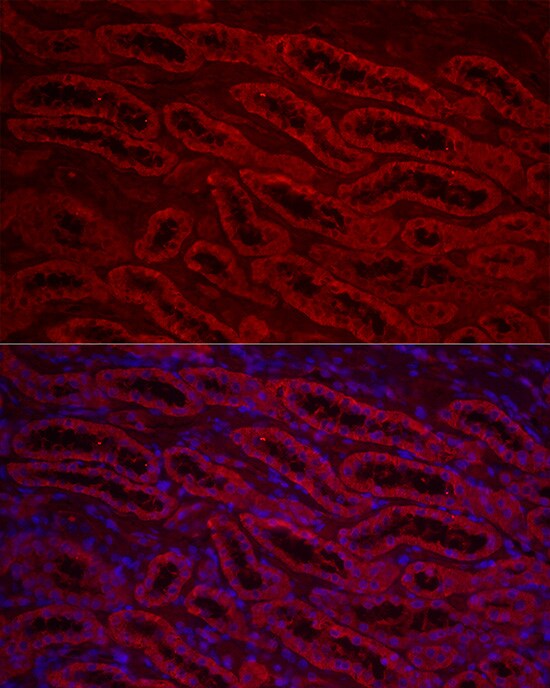 ACSL1 Antibody - Azide and BSA Free