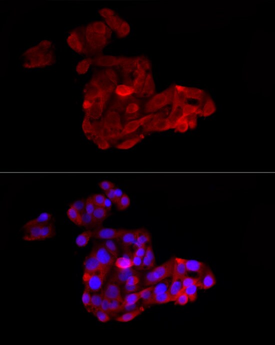ACSL1 Antibody - Azide and BSA Free