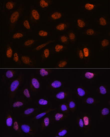CSTF2T Antibody - BSA Free
