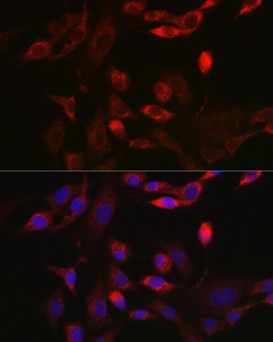 BNIP3L Antibody - Azide and BSA Free