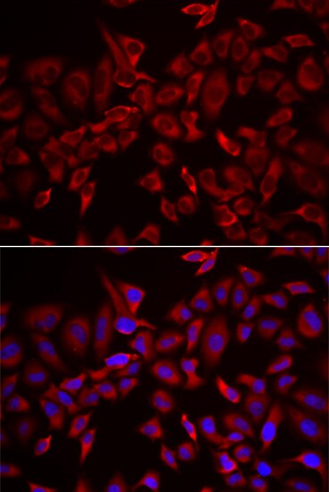 CSRP3 Antibody - BSA Free