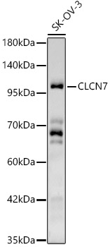 CLCN7 Antibody - BSA Free