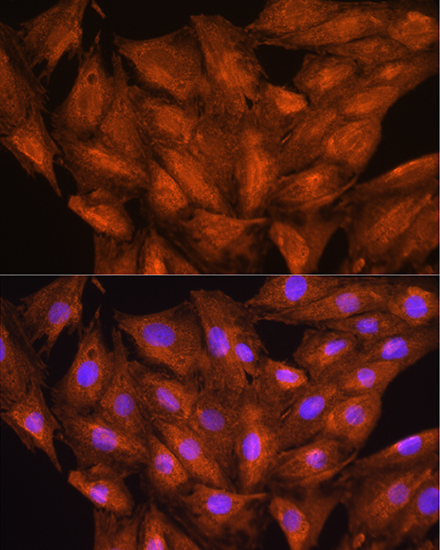 DAAM2 Antibody - BSA Free