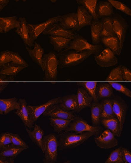 DAAM2 Antibody - BSA Free