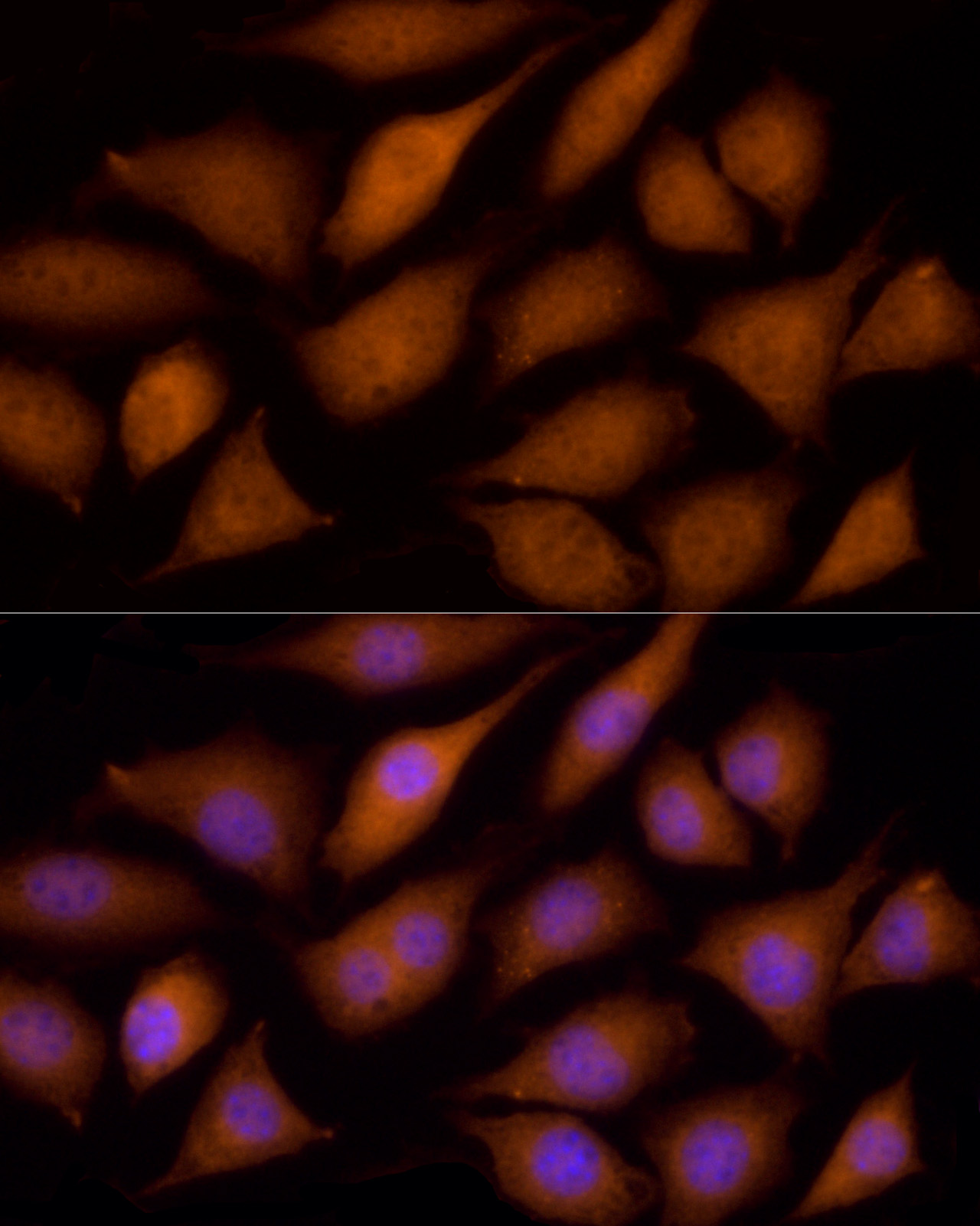 ECSIT Antibody - BSA Free