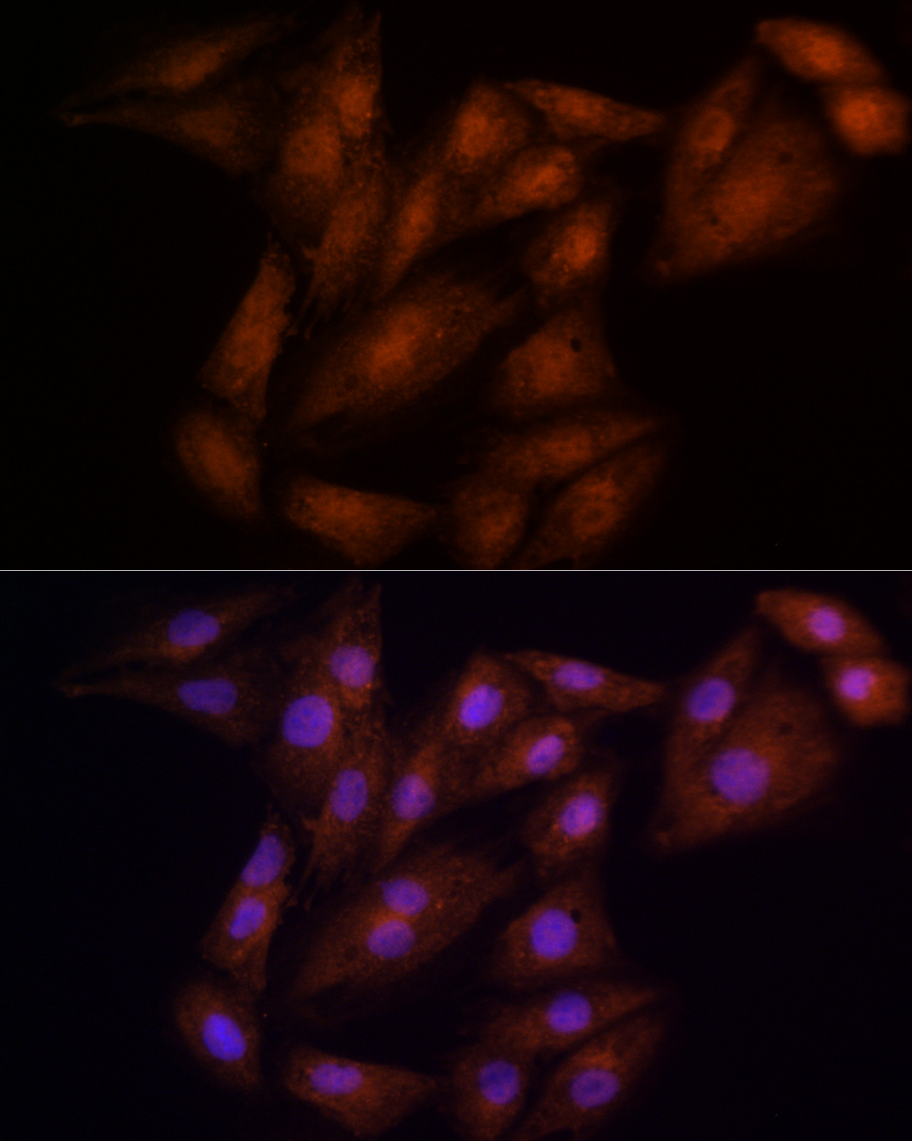 ECSIT Antibody - BSA Free