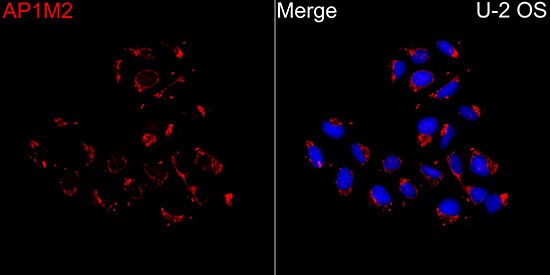AP1M2 Antibody - BSA Free