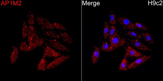 AP1M2 Antibody - BSA Free